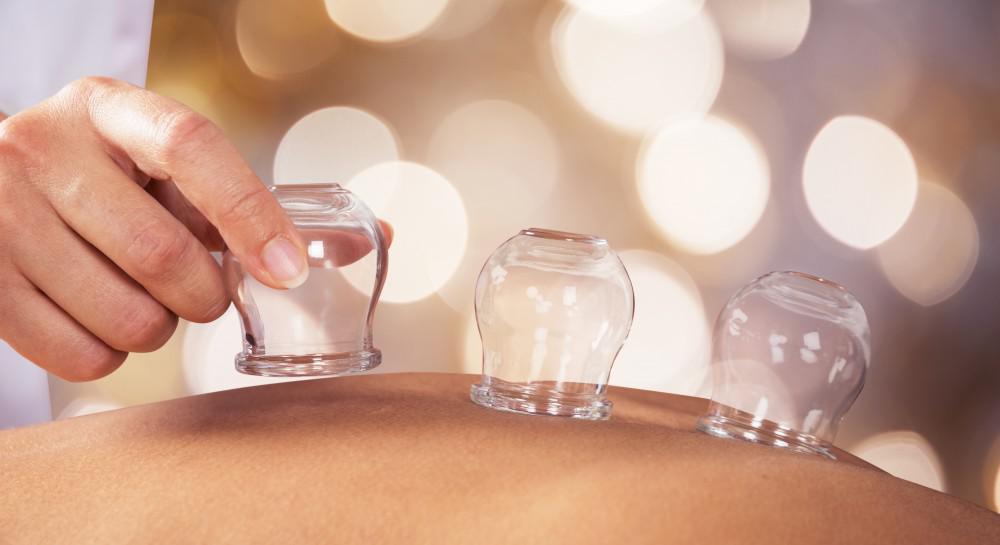 Cupping Therapy